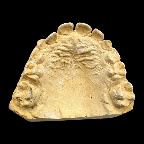 Vintage Plaster Dental Mold - Teeth Tooth Mold - Creepy Oddity - Dental Oddities - Picture 9 of 16